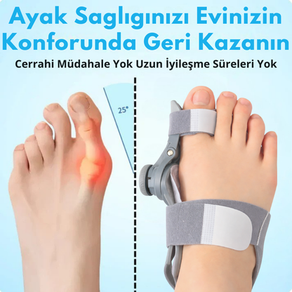 Bunyon İçin Ortopedik Ayak Aparatı